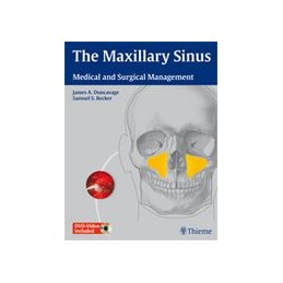 The Maxillary Sinus: Medical and Surgical Management
