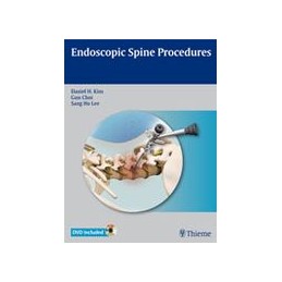 Endoscopic Spine Procedures