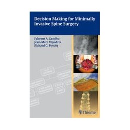 Decision Making for Minimally Invasive Spine Surgery