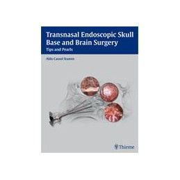 Transnasal Endoscopic Skull...