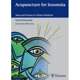 Acupuncture for Insomnia:...
