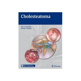 Cholesteatoma