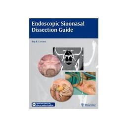 Endoscopic Sinonasal...