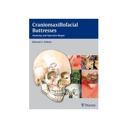 Craniomaxillofacial Buttresses: Anatomy and Operative Repair