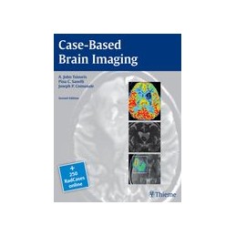 Case-Based Brain Imaging