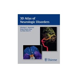 3D Atlas of Neurologic Disorders