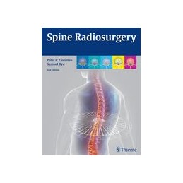 Spine Radiosurgery