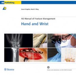 AO Manual of Fracture...