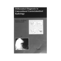 Differential Diagnosis in Conventional Gastrointestinal Radiology: Excerpt from Differential Diagnosis in Conventional Radiology
