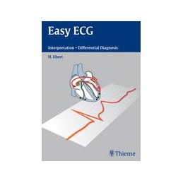 Easy ECG