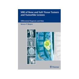 MRI of Bone and Soft Tissue Tumors and Tumorlike Lesions