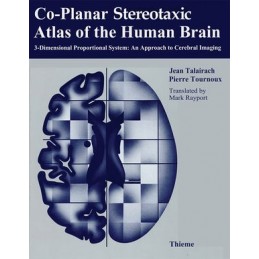 Co-Planar Stereotaxic Atlas of the Human Brain: 3-Dimensional Proportional System: An Approach to Cerebral Imaging