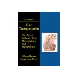 Hair Transplantation: The...