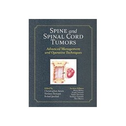 Spine and Spinal Cord Tumors: Advanced Management and Operative Techniques