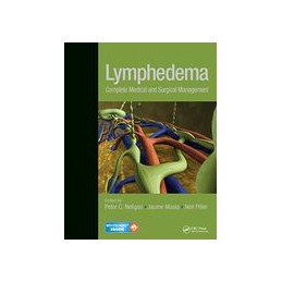 Lymphedema: Complete Medical and Surgical Management