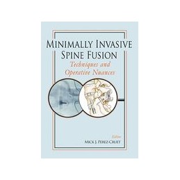 Minimally Invasive Spine Fusion: Techniques and Operative Nuances