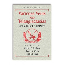 Varicose Veins and...
