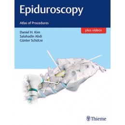 Epiduroscopy: Atlas of...