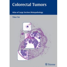 Colorectal Tumors: Atlas of Large Section Histopathology
