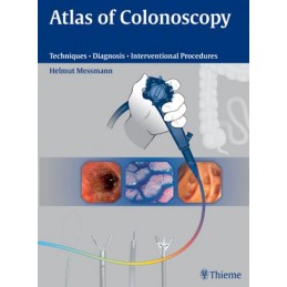 Atlas of Colonoscopy: Techniques - Diagnosis - Interventional Procedures