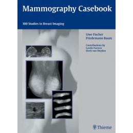 Mammography Casebook: 100...