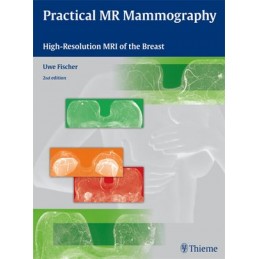 Practical MR Mammography:...