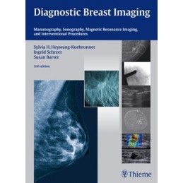 Diagnostic Breast Imaging:...