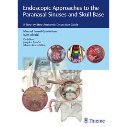 Endoscopic Approaches to the Paranasal Sinuses and Skull Base: A Step-by-Step Anatomic Dissection Guide