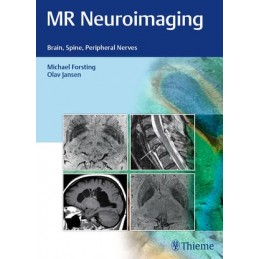 MR Neuroimaging: Brain,...