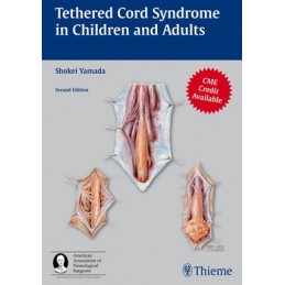 Tethered Cord Syndrome in...