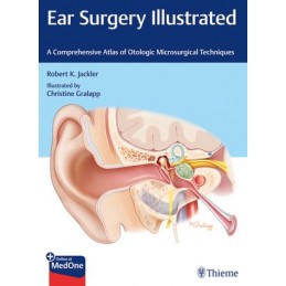 Ear Surgery Illustrated: A Comprehensive Atlas of Otologic Microsurgical Techniques