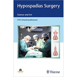 Hypospadias Surgery: Science and Art