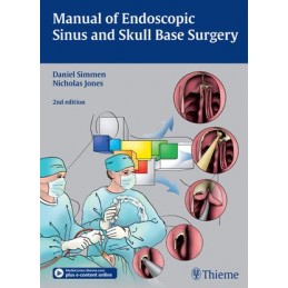 Manual of Endoscopic Sinus...