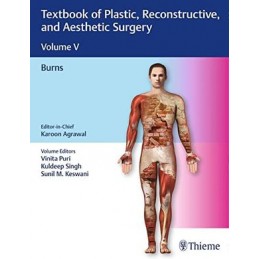 Textbook of Plastic, Reconstructive, and Aesthetic Surgery, Vol 5: Burns