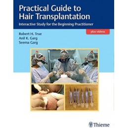 Practical Guide to Hair Transplantation: Interactive Study for the Beginning Practitioner