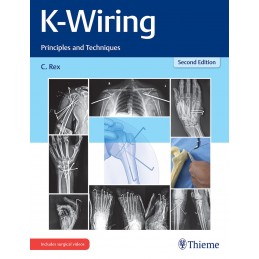 K-Wiring: Principles and Techniques