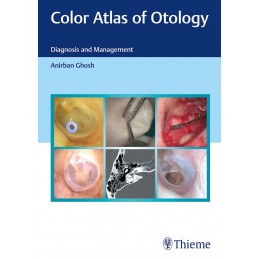 Color Atlas of Otology: Diagnosis and Management