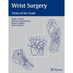 Wrist Surgery: Tricks of the Trade