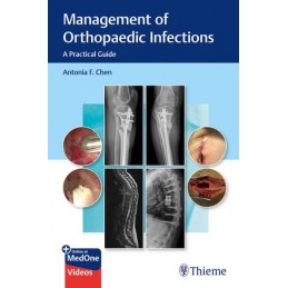 Management of Orthopaedic...