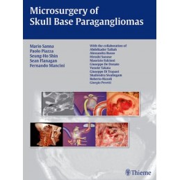 Microsurgery of Skull Base Paragangliomas