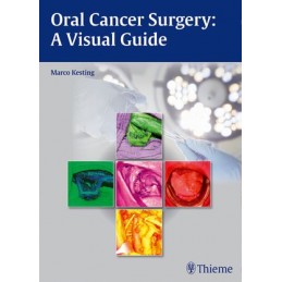 Oral Cancer Surgery: A Visual Guide