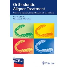 Orthodontic Aligner Treatment: A Review of Materials, Clinical Management, and Evidence