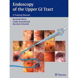 Endoscopy of the Upper GI...