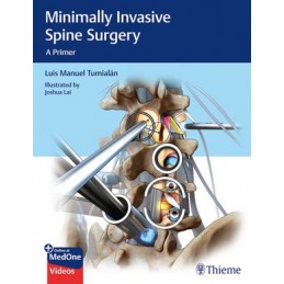 Minimally Invasive Spine Surgery: A Primer