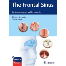 The Frontal Sinus: Surgical...