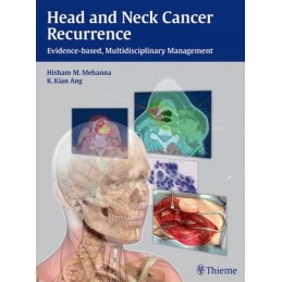 Head and Neck Cancer Recurrence: Evidence-based, Multidisciplinary Management