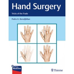 Hand Surgery: Tricks of the...