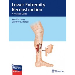 Lower Extremity...