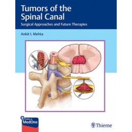 Tumors of the Spinal Canal: Surgical Approaches and Future Therapies