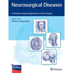 Neurosurgical Diseases: An...